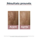 Eucerin – Anti-pigment Sérum Duo – 30 Ml