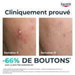 Eucerin – Dermopure Clinical Sérum Triple Action – 40 Ml