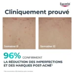Eucerin DermoPure Triple Effect Body Cream 200Ml