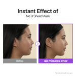 Numbuzin – No.9 NAD+ BIO Lifting-sil Full Face Mask – 4 Sheets + Lifting Band