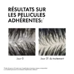 Dercos Eco-recharge Shampooing Antipelliculaire Normaux à Gras Vichy