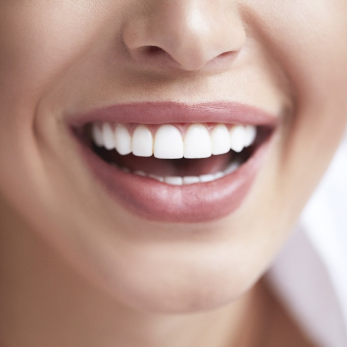 Sourire aux gencives saines - Sanogyl